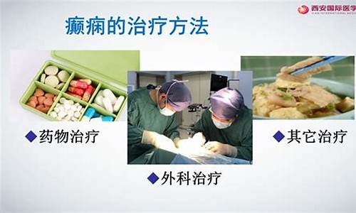 癲癇最新治療療法